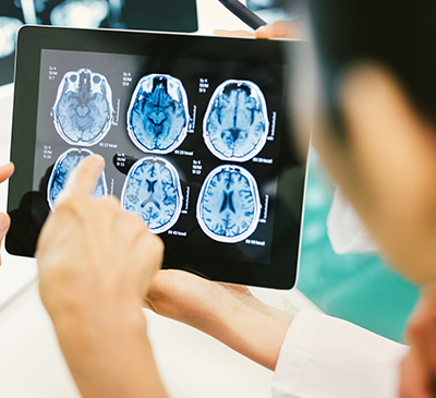 Adrenomyeloneuropathy - A Pipeline Analysis Report